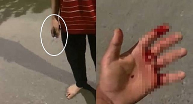 Urfa’da İlçe Başkanının Oğlu Bıçaklandı