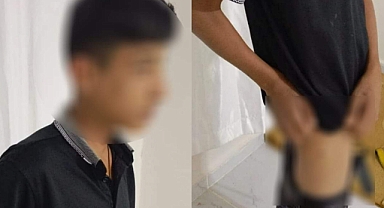 Urfa'da Sokak Köpeği Çocuğu Isırdı