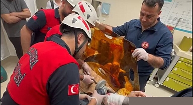 Şanlıurfa’da Koluna İnşaat Demiri Saplanan Vatandaş Kurtarıldı