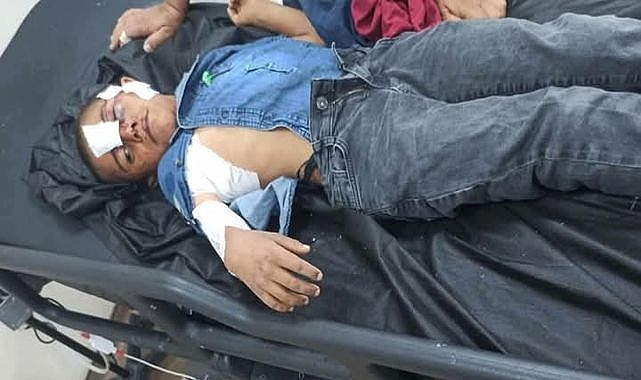 Şanlıurfalı Mahmut, Konya’da Başıboş Köpeklerin Hedefi Oldu!