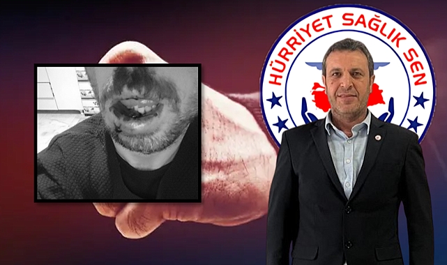 Başkan Bekir Baran: ‘Saldırganın Serbest Bırakılması Kabul Edilemez!’